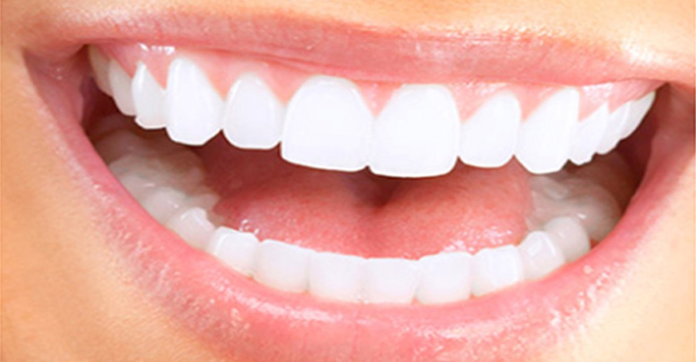 Esthétique du sourire